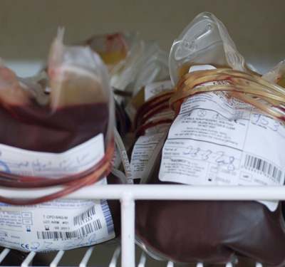 Blood transfusions can be life saving; but they may be resorted to more often than needed.